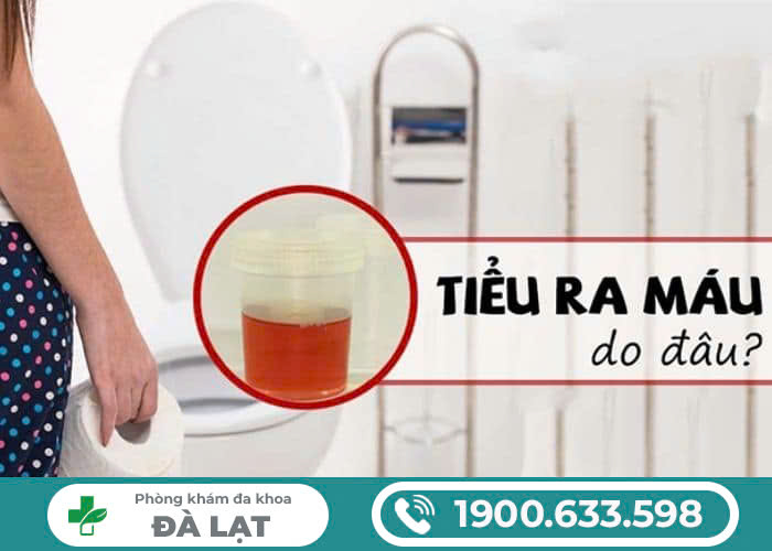 ĐI TIỂU RA MÁU Ở NAM VÀ NỮ GIỚI LÀ BỆNH GÌ?
